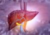 Understanding Fatty Liver Disease: Symptoms, Causes, and Treatment