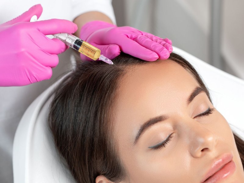 GFC Treatment (Growth Factor Concentrate) for Hair Loss in Pune- Dr. Kiran Ardad-Mane