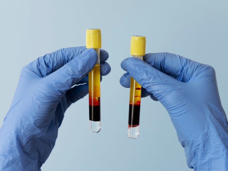 P-Shot Treatment (Priapus Shot) in Pune- Dr. Akhil S Mane | Leela Superspeciality Hospital