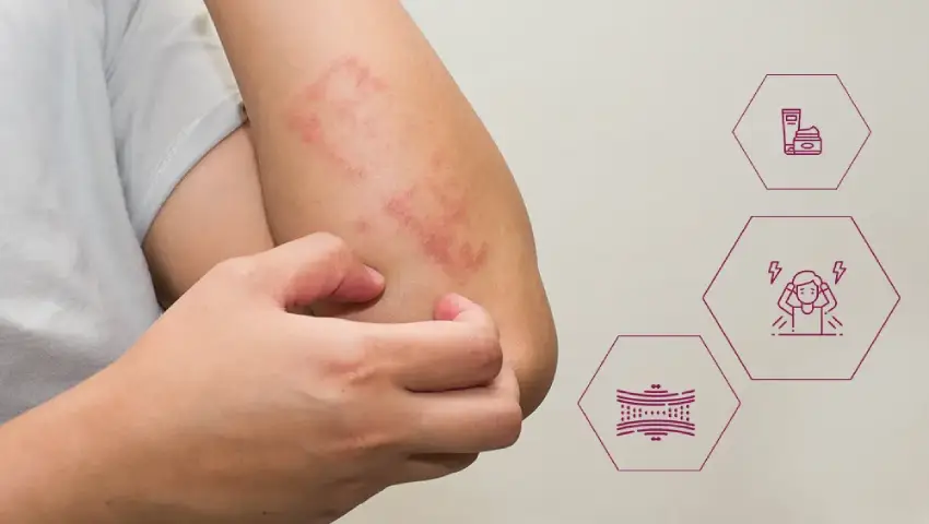 Skin Allergies: Symptoms, Triggers, and How to Avoid Them?