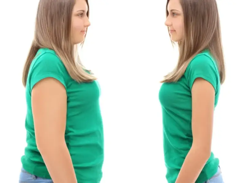 Liposuction Surgery in Pune- Dr. Kiran Ardad-Mane at Leela Superspeciality Hospital