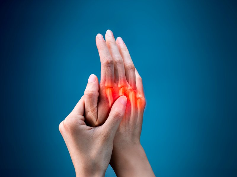 Swollen hand joints indicating arthritis pain – arthritis treatment in Pune