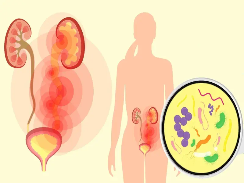 uti fever treatment | Dr. Sarang Barbind | Leela Superspeciality Hospital, Wakad