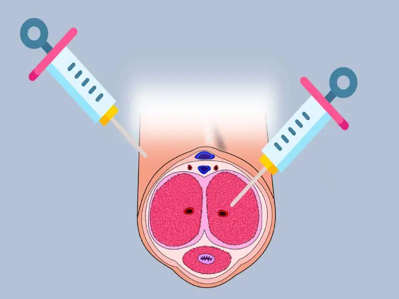 Penile Injection Therapy | Intrapenile Injection Therapy - Dr. Akhil S Mane | Leela Superspeciality Hospital, Wakad