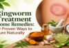Effective Ringworm Treatment Home Remedies using natural ingredients like turmeric and garlic.